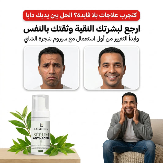 سيروم الألوفيرا المضاد لحب الشباب